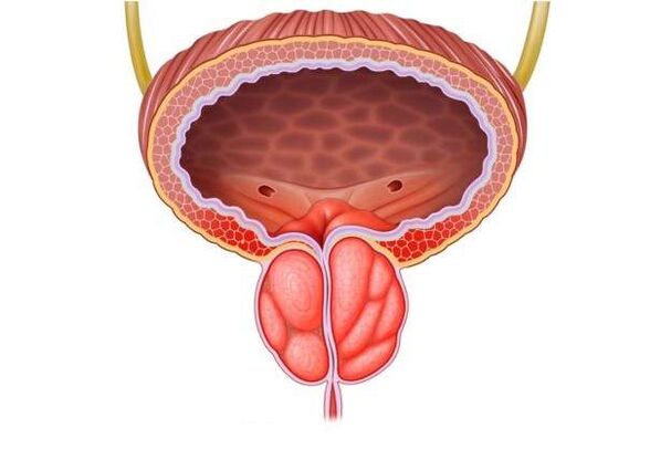 Traitement de la prostatite chez les hommes